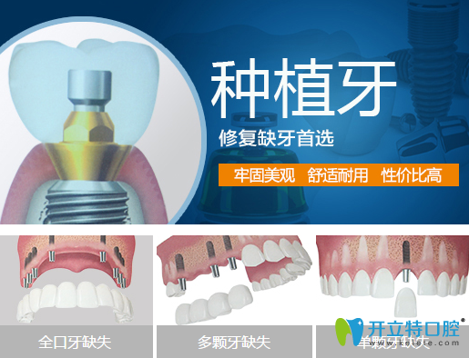 牙齒缺失說話漏風(fēng)？德陽新橋口腔種植牙幫你改善缺牙問題
