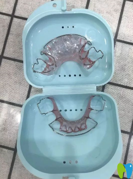 我的牙齒保持器