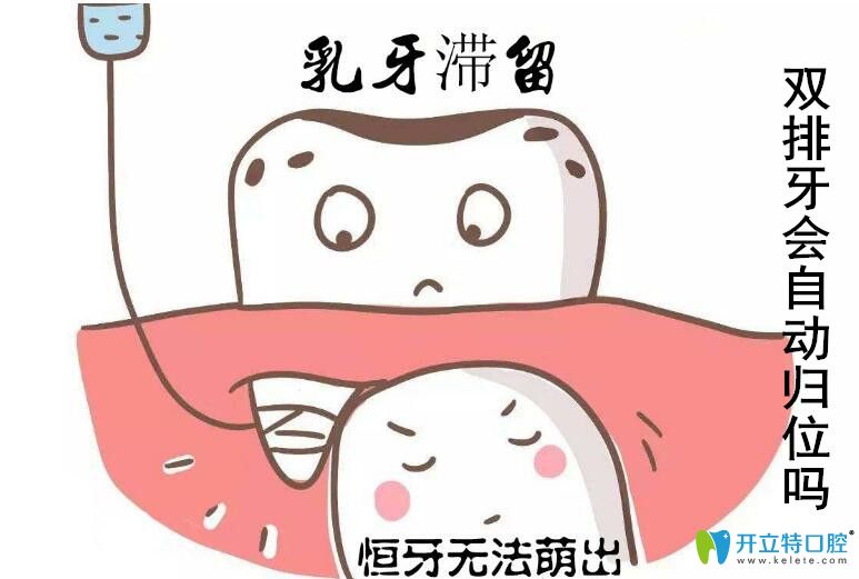 兒童出現(xiàn)了雙排牙怎么辦，會(huì)不會(huì)自從歸位