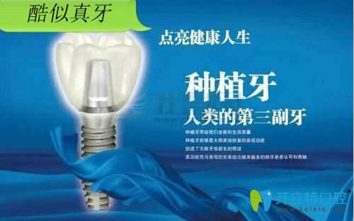 整理的韓國種植牙品牌排行榜中內附奧齒泰/登騰等植體價格