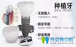沈陽歡樂口腔科普種植牙的適應(yīng)人群及參考價格