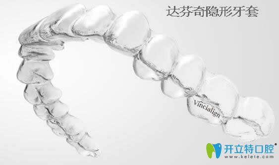 知否:國產(chǎn)達(dá)芬奇隱形牙套多少錢及矯正效果怎么樣