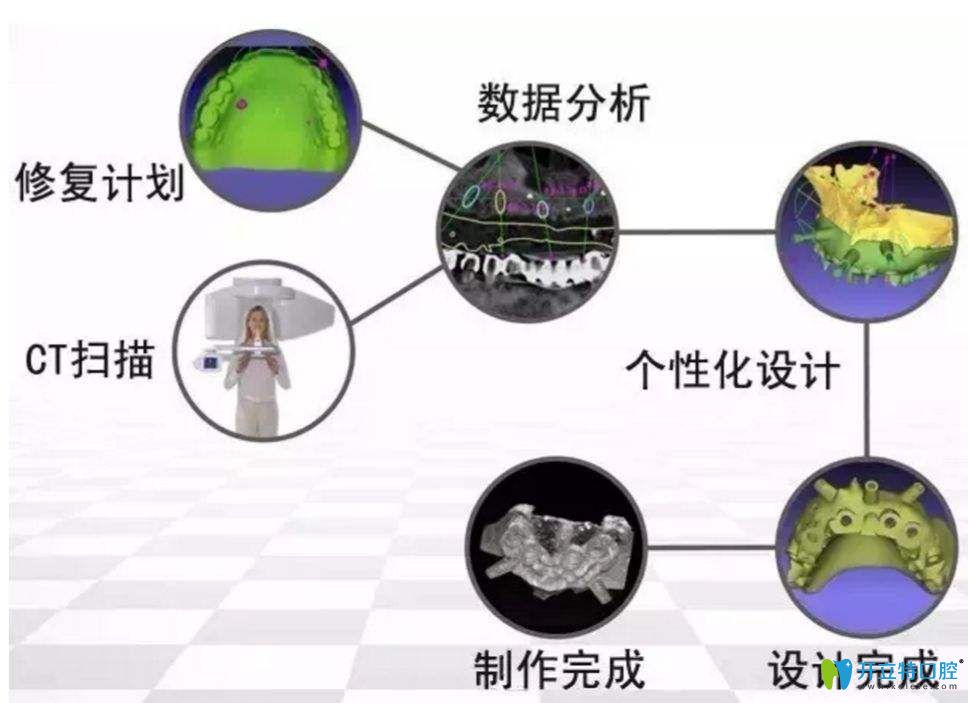南昌輝煌口腔丁張松醫(yī)生介紹數字化種植牙技術優(yōu)勢