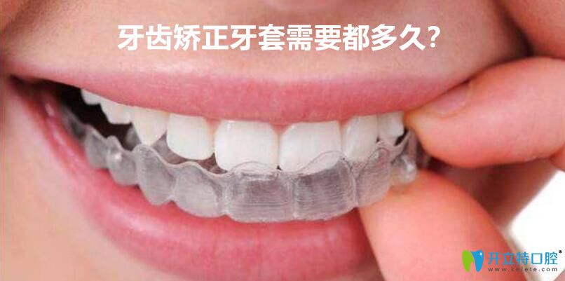 牙套要帶多久？牙齒矯正選擇傳統(tǒng)的牙套好還是隱形的好？