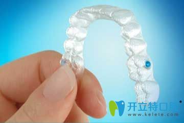 我在北京瑞鯊口腔戴的隱適美牙套 我在北京瑞鯊口腔戴的隱適美牙套