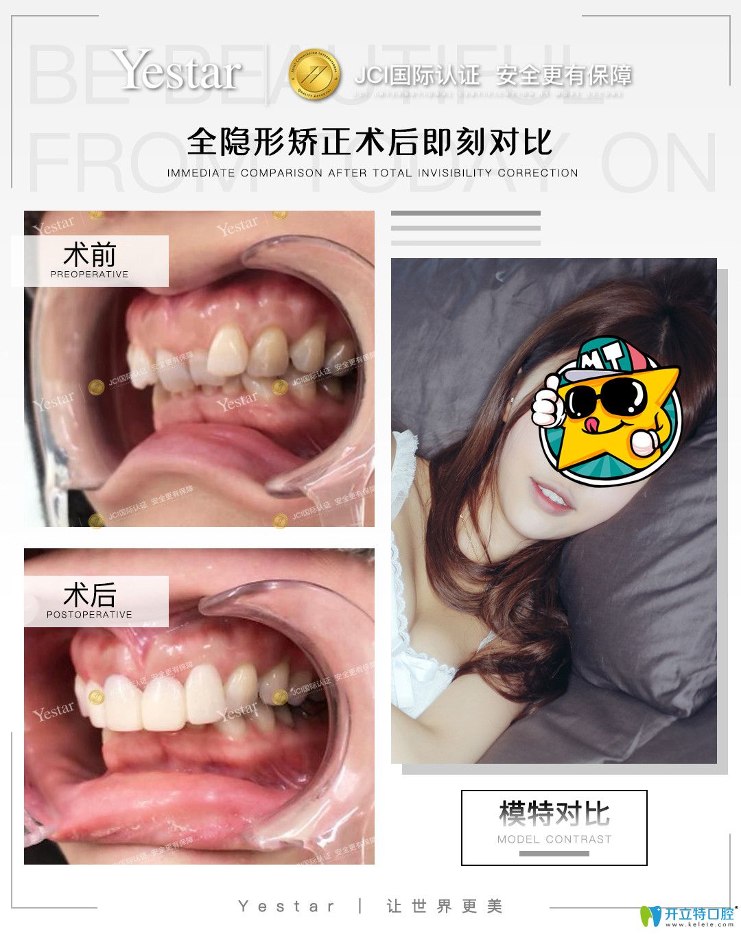在寧波藝星口腔戴隱形牙套是什么感受，真實(shí)正畸經(jīng)驗(yàn)分享