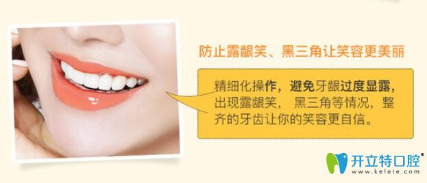 防止牙齒矯正過程中的露齦笑、黑三角