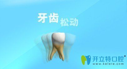 牙齒松了可以固定嗎,那些問(wèn)牙齒松了怎么拔的人怎么想的？