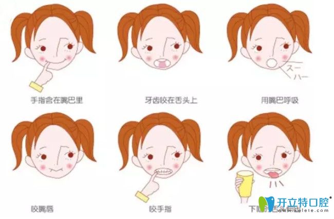 咬合誘導(dǎo)技術(shù)都有哪些？兒童咬合誘導(dǎo)有啥副作用？