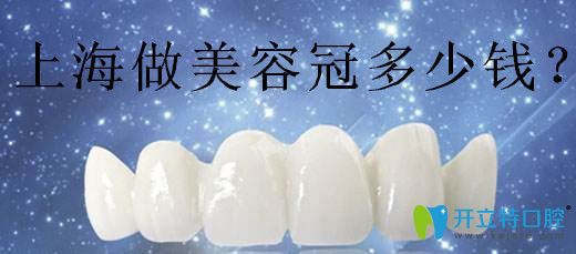上海做鑲牙的醫(yī)院哪家好?鼎植/雅悅經濟實惠且技術排名靠前