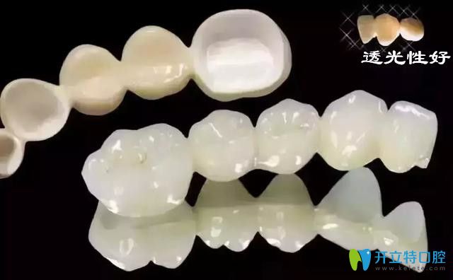 武漢做全瓷牙冠多少錢一顆?進(jìn)口全瓷牙三大品牌價(jià)格也不同