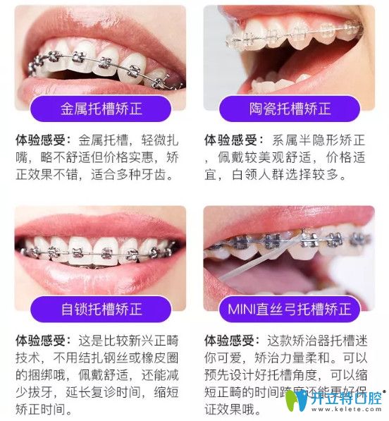 <!--<i data=20240703-sp></i>-->永華口腔牙齒矯正項目