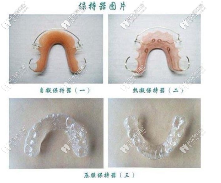 網(wǎng)上找的保持器圖片，我戴的是透明的保持器