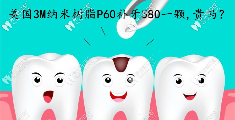 在煙臺(tái)做美國(guó)3MP60納米樹(shù)脂補(bǔ)牙580一顆，這費(fèi)用算貴嗎