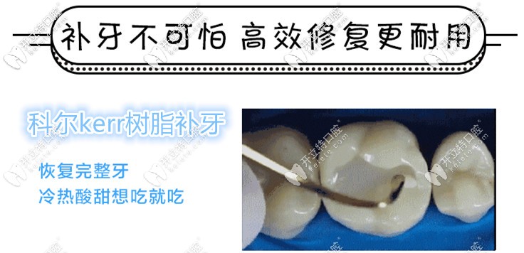 美國科爾kerr樹脂補牙多少錢一顆,與3m價位相差大嗎？