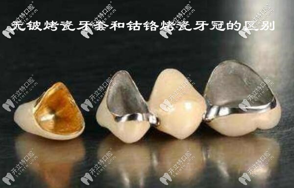 無(wú)鈹烤瓷牙和鈷鉻烤瓷牙冠的區(qū)別不止是價(jià)格,還有材質(zhì)哦!