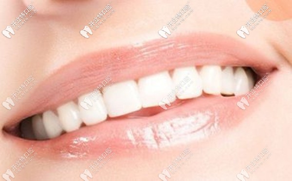 咸陽(yáng)市牙科醫(yī)院牙齒美白修復(fù)的價(jià)格