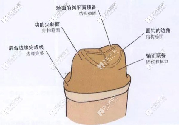 頜面的牙冠預(yù)備工作