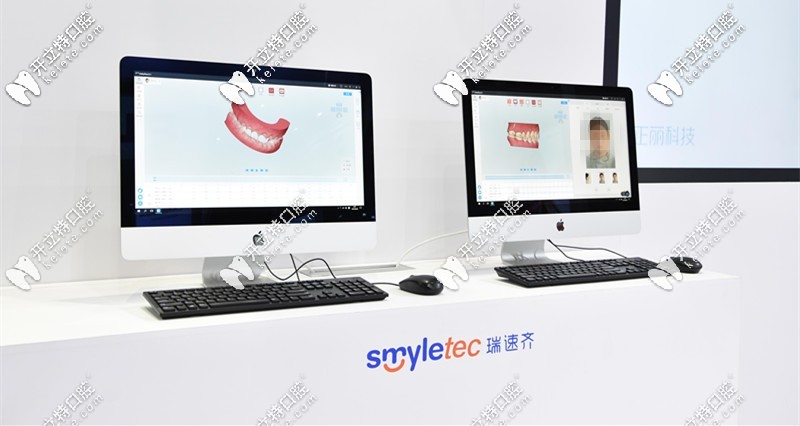 瑞速齊隱形矯正價格是多少錢？Smyletec是哪個國家的？