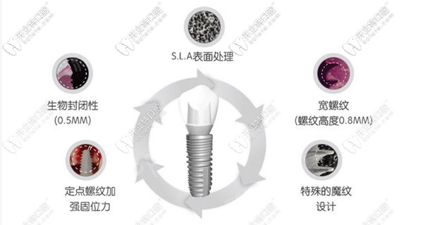 上海曙康口腔種植牙價(jià)格表公布,來看曙康種植牙多少錢一顆?