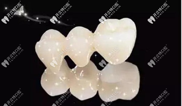 西安美奧口腔全瓷牙價(jià)格就在這,不要擔(dān)心國產(chǎn)愛爾創(chuàng)收費(fèi)貴