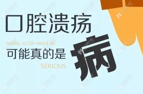 口腔潰瘍