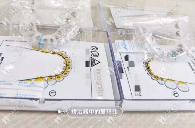 3m黃金incognito舌側(cè)隱形矯正價(jià)格一般是多少？講講它的優(yōu)缺點(diǎn)