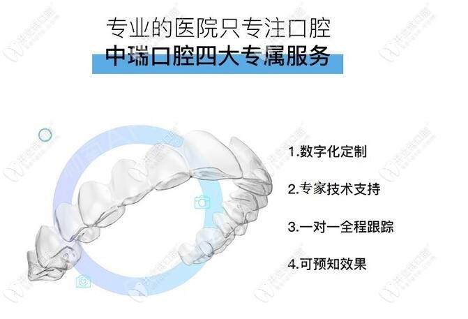 隱形矯正器的優(yōu)勢(shì)