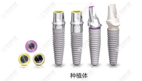 分享沈陽盛大口腔價格表，盛大做種植牙口碑好價格還不貴